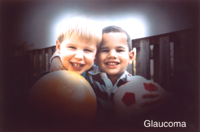 Two boys in front of a stand of trees. The edges of the images are extremely dark, so only one boy's face and a portion of the other's can be made out.